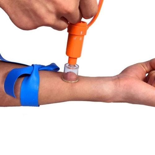 Insect Bite Extractor